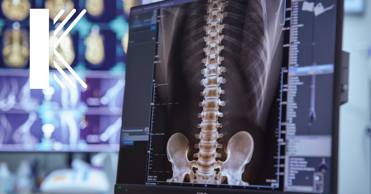 A close-up view of a medical monitor displaying a detailed X-ray of a human spine, with the Kastner Insurance logo prominently featured on the left side. The background shows additional medical imaging screens, indicating a chiropractor's office or a medical facility specializing in spinal care.